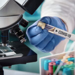 Border Screening Faces Ebola Test Scientist holding a test tube labeled COVID-19 next to a microscope