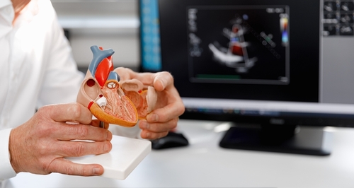 Healthcare professional holding a 3D heart model in front of a computer screen